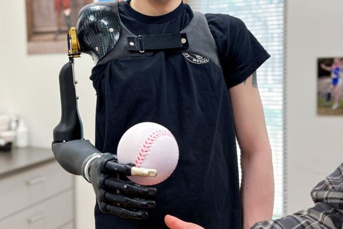 Elbow Disarticulation
