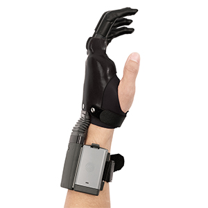 Upper Extremity Prosthetics